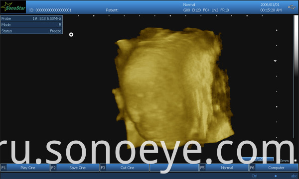 image for labtop ultrasound